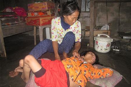 Làng trẻ em mắc bệnh khuyết tật nhiều bất thường ở Quảng Nam